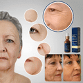 SkinRevive™ | Få synligt løftet hud og færre linjer