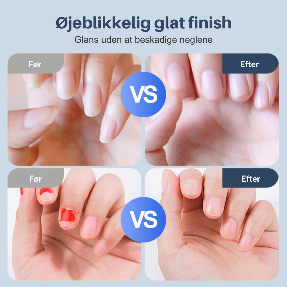 ManiCare™ | Gør neglepleje tryg og ubesværet igen