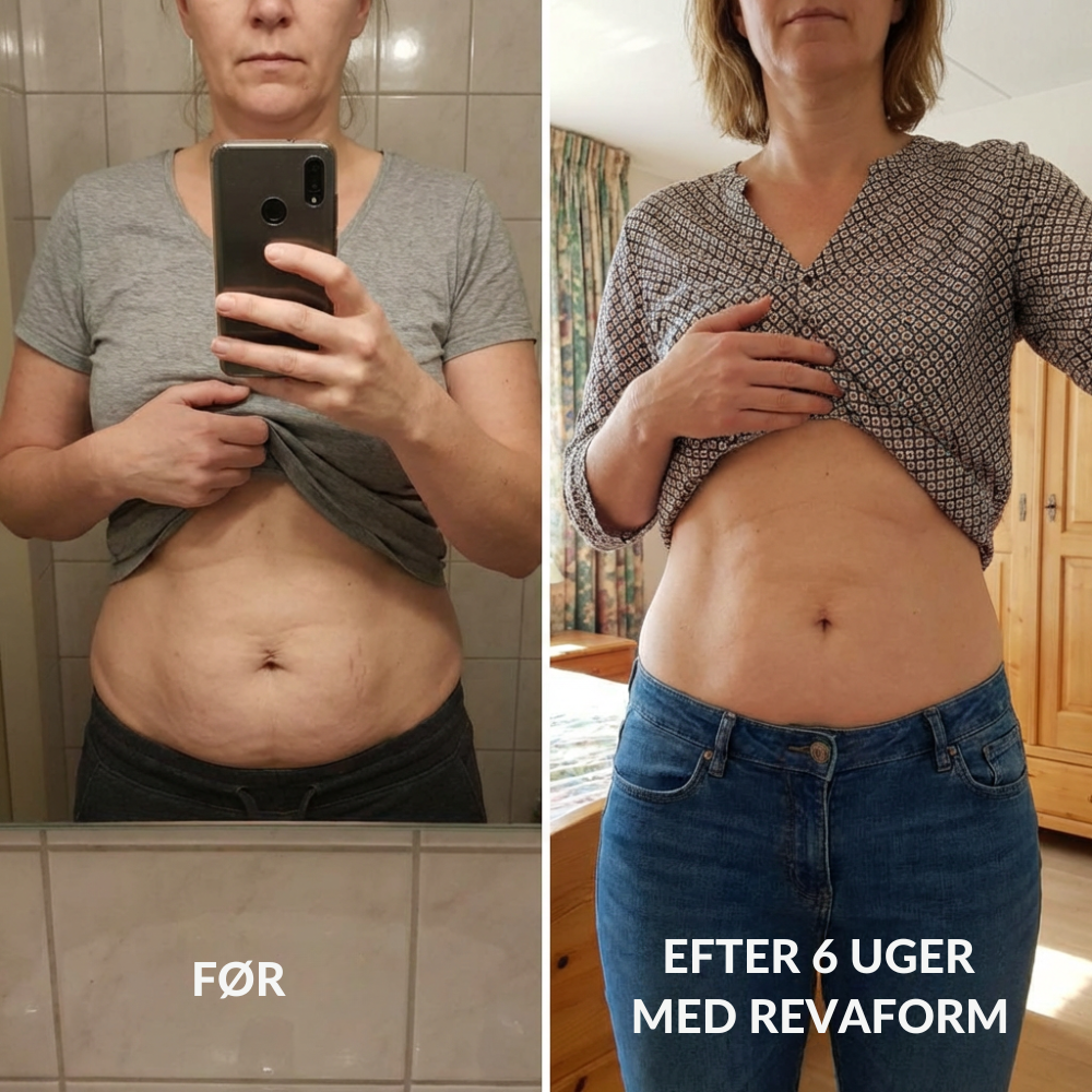 RevaForm™ | Få fastere hud og mere selvtillid tilbage