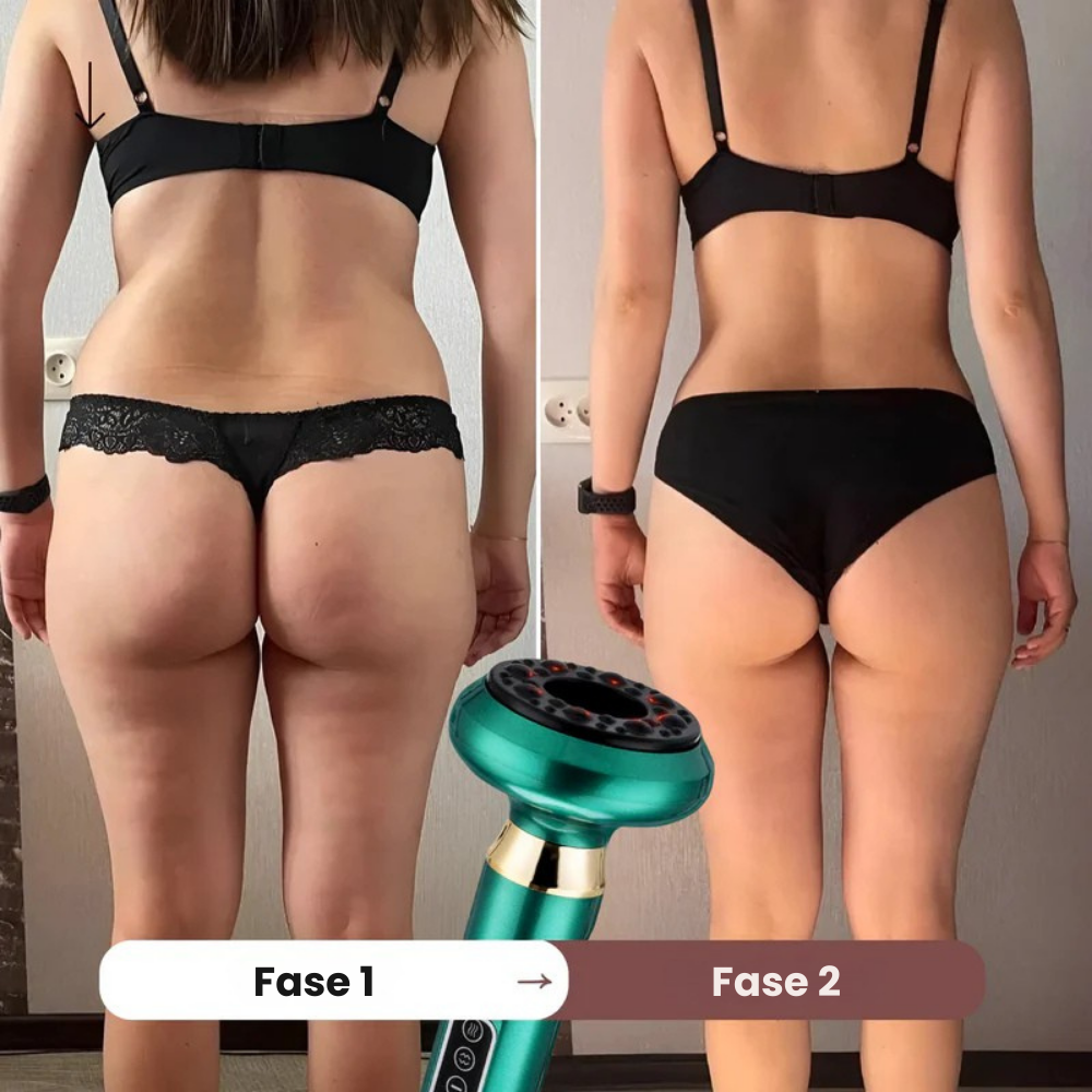CelluSculpt™ | Oplev en synligt glattere og strammere hud