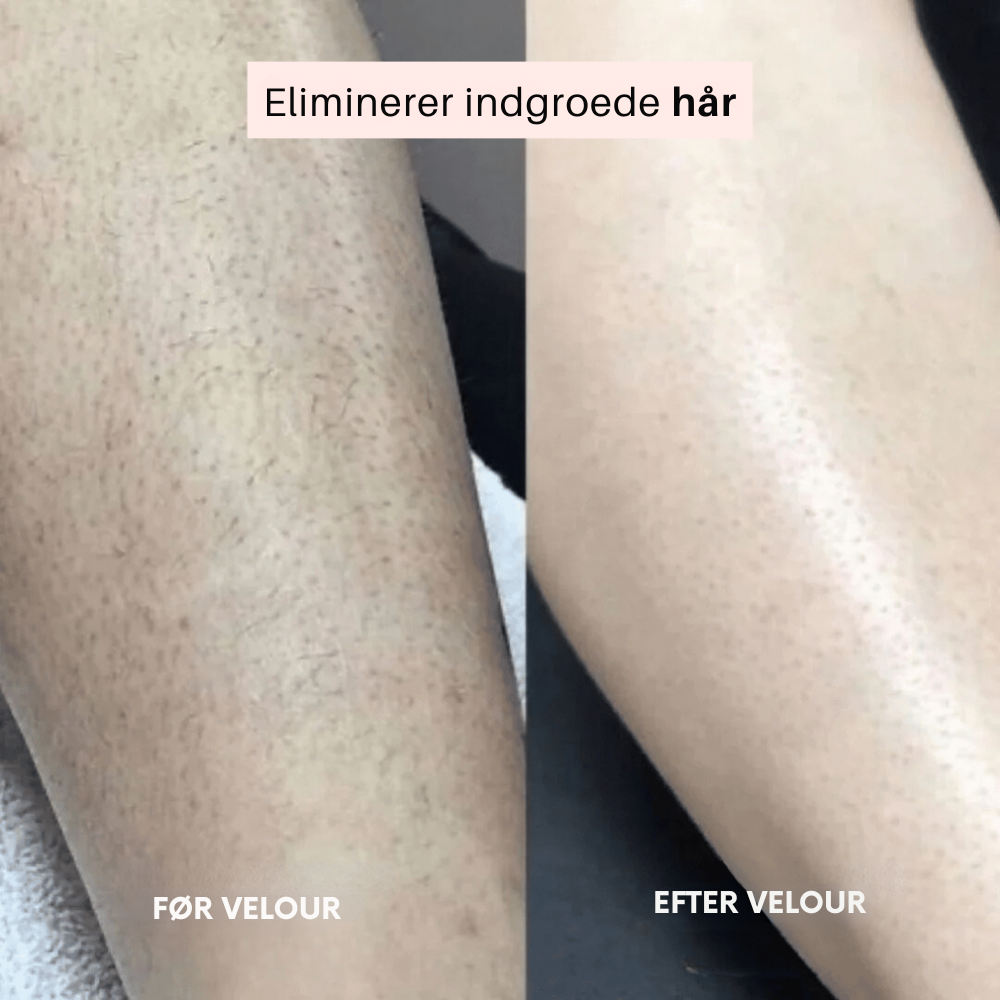 Velour™ | Blød, glat hud uden irritation