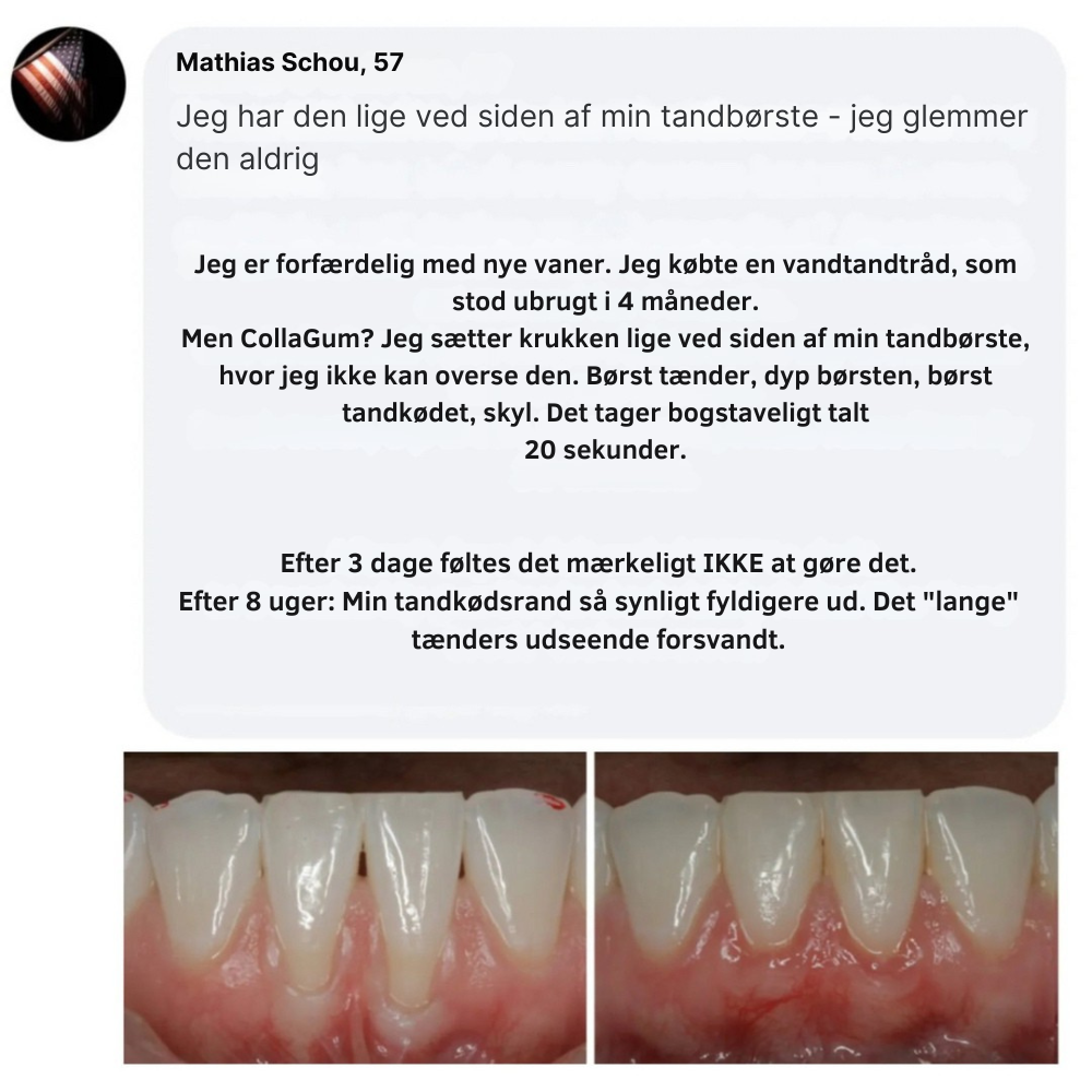CollaGum™ | Styrk dit tandkød indefra og bevar dit naturlige smil