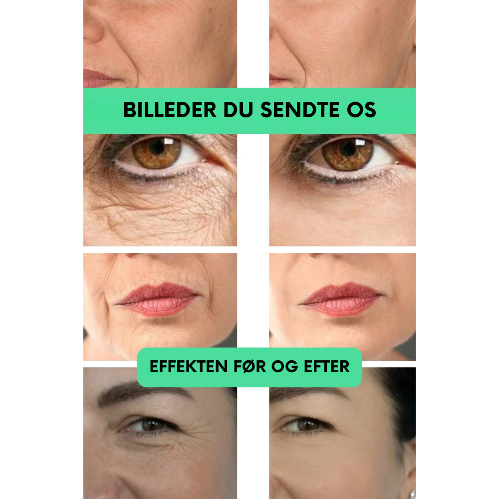 GoldenBliss™ | Giv huden den gyldne glød tilbage