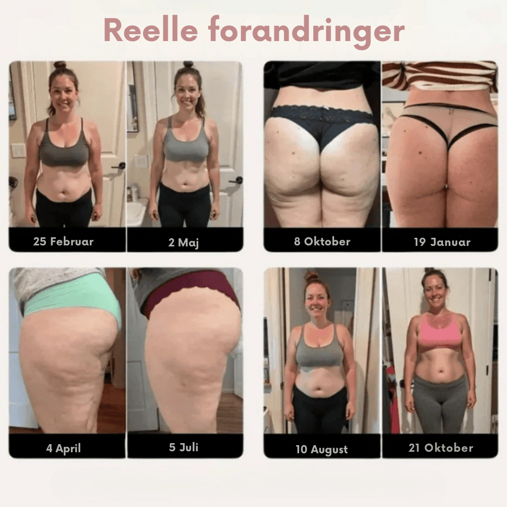 SculptWear™ | Leggings der arbejder aktivt mod cellulite