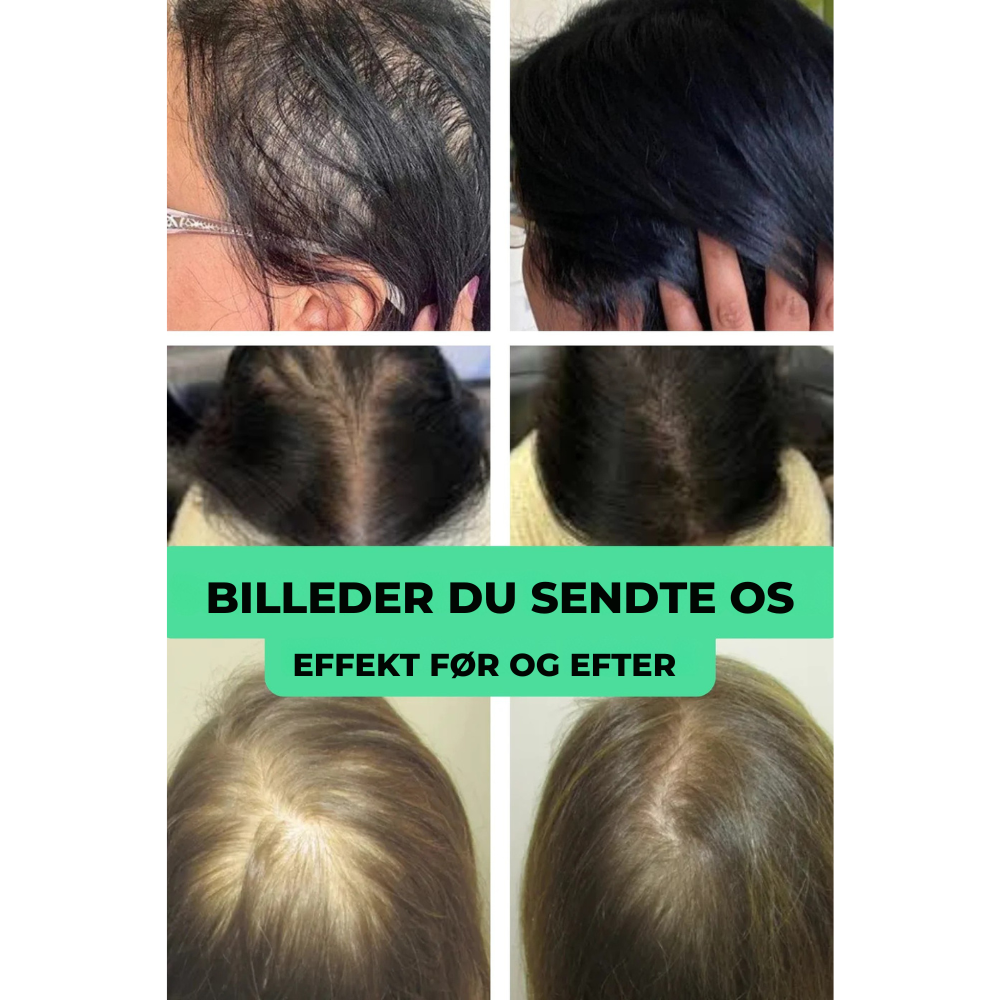 RootRevive™ | Få fyldigere hår og mere selvtillid