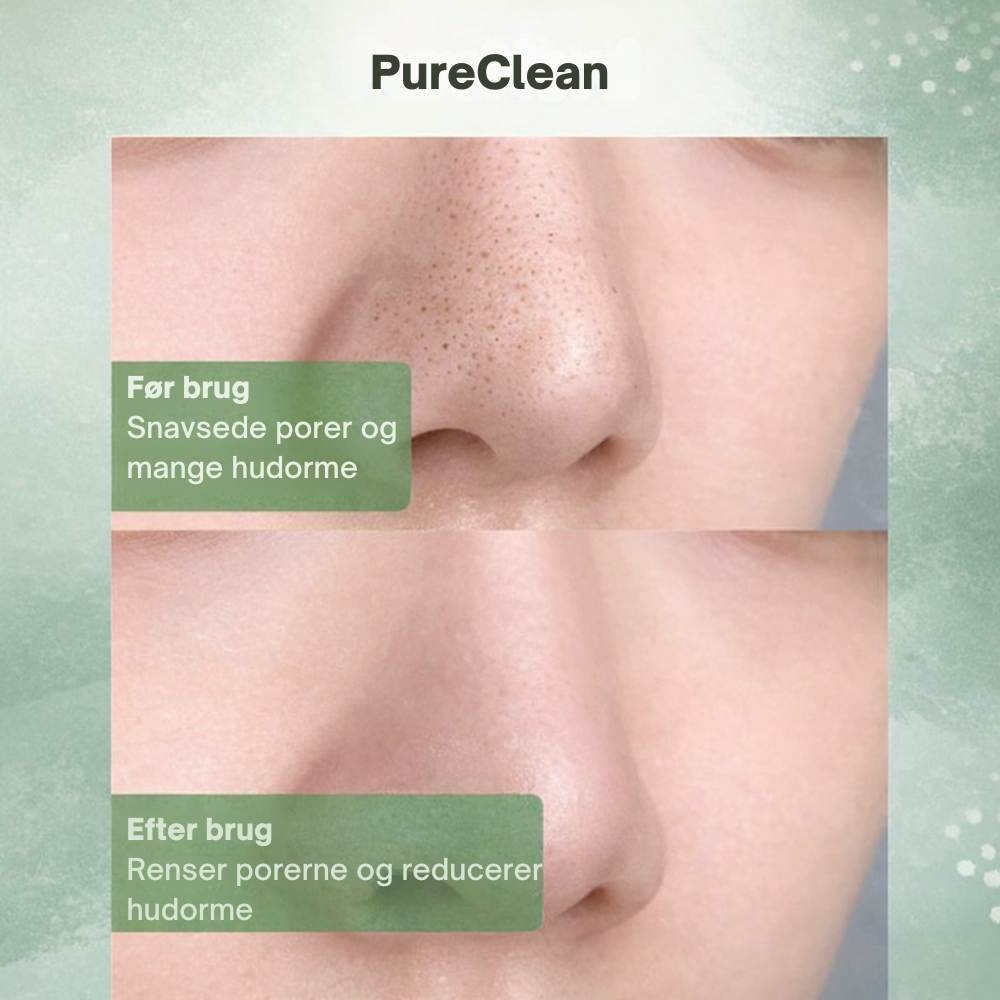 PureClean™ | Klar hud starter med rene porer