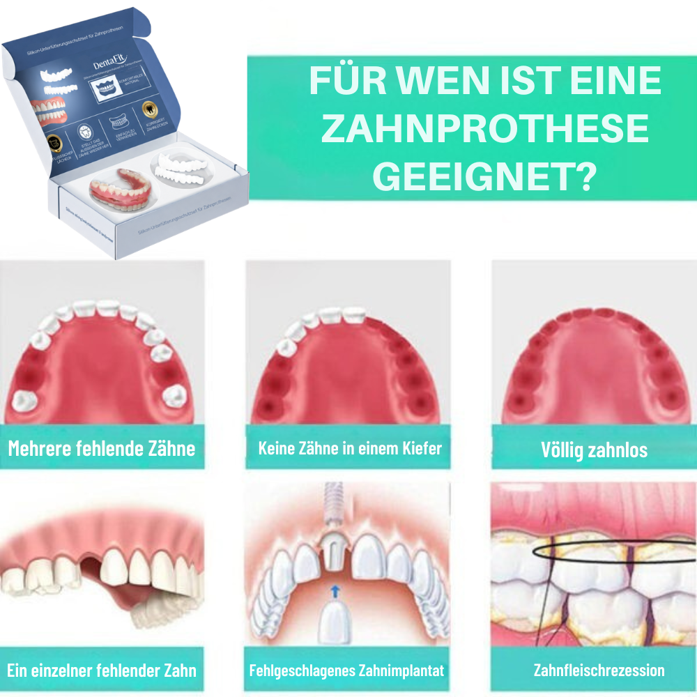 DentaFit™ | Das perfekte und sofortige Lächeln, ohne Schmerzen und ohne Termin