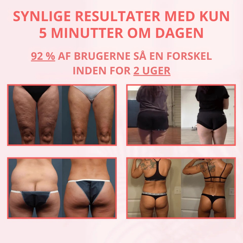 CelluSculpt™ | Føl dig mere selvsikker i glattere hud til sommer